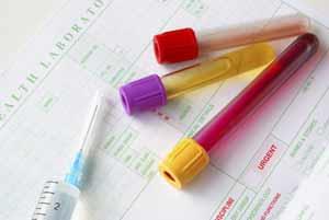 You can now book your blood test online